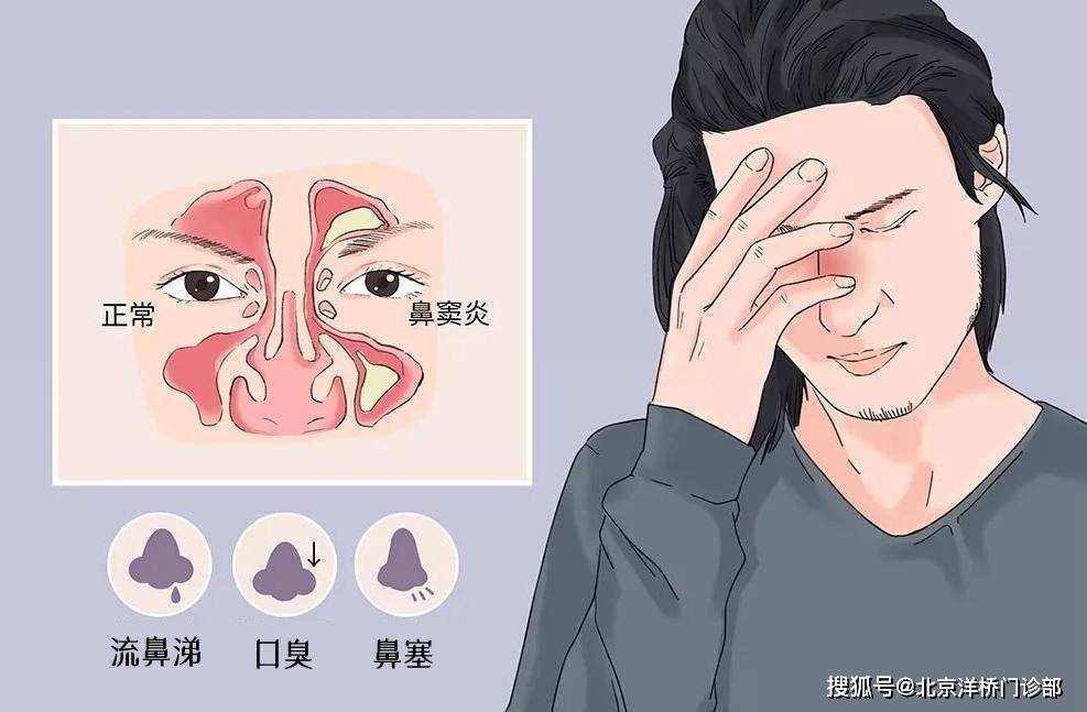 港版和韩版有啥区别苹果:冬季鼻炎易加重，感冒和鼻炎到底有啥区别？